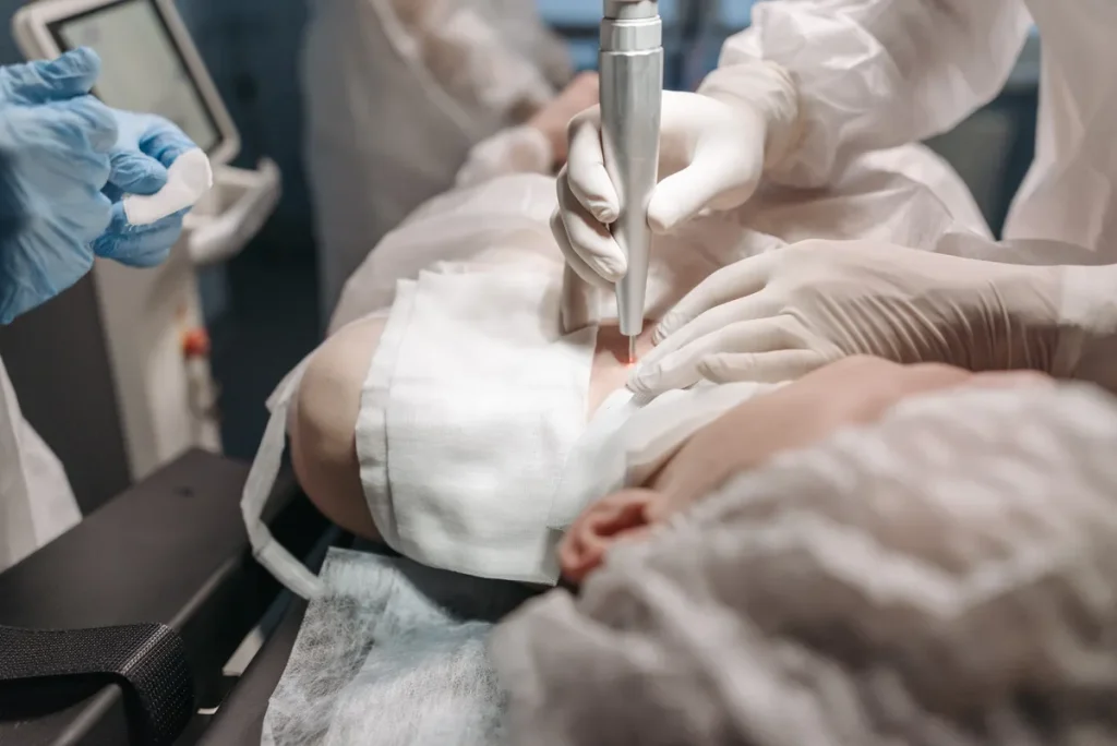 laser tattoo removal darker skin